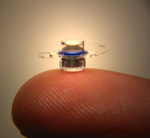 The pea-sized implantable telescope helps improve vision in patients with the most advanced form of macular degeneration, while being virtually unnoticeable in the eye.   (Provided by Sarasota Memorial Hospital)